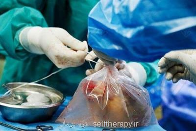 اعضای بدن جوان 29 ساله اردبیلی به بیماران نیازمند اهدا شد