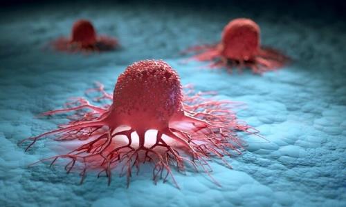 اهمیت تشخیص سریع سرطان ها