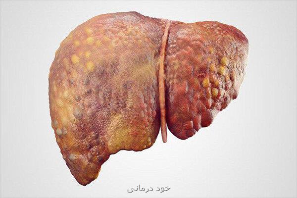 پیش بینی بیماری کبد چرب