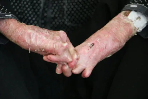 لزوم اطلاع رسانی در رابطه با ازدواج های فامیلی و بیماری های ژنتیکی