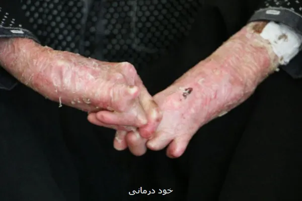 لزوم اطلاع رسانی در رابطه با ازدواج های فامیلی و بیماری های ژنتیکی