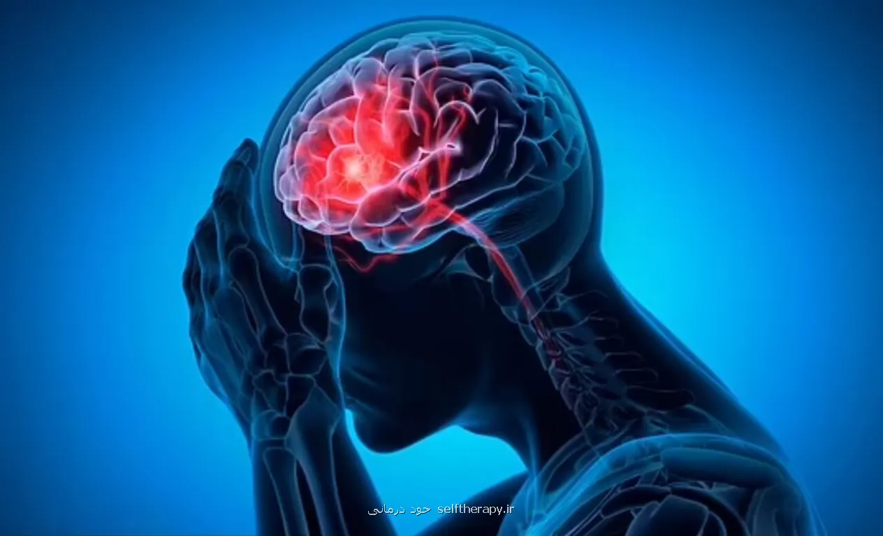 علایم اخطار سکته مغزی در ۹۰ روز آینده