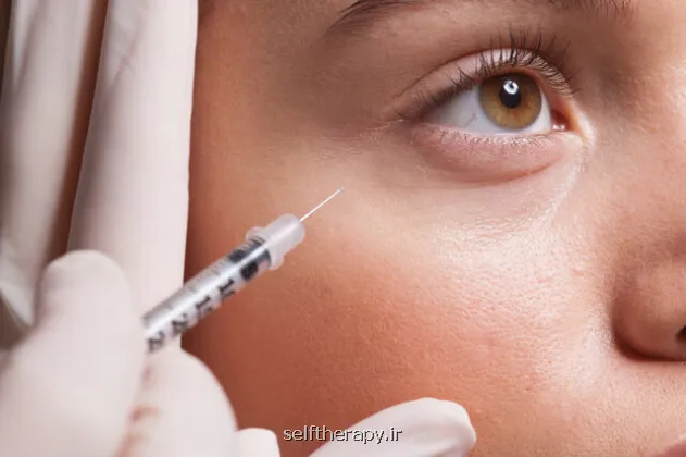 هشدار جدی درباره ی تزریق فیلر این عوارض می تواند به نابینایی و سکته مغزی منجر شود