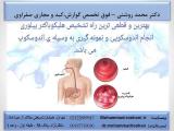 ورم معده