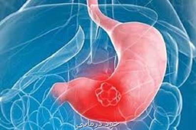 75 درصد جامعه ایرانی گرفتار میكروب هلیكوباكتری هستند