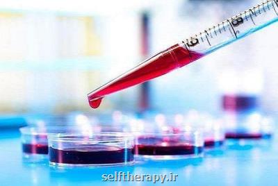 تشخیص آلزایمر با وجود میزان مس در خون